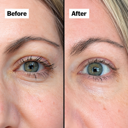 ELVEO Overnight Vitamin C Eye Balm